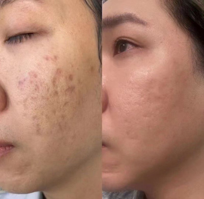 皮肤管理新时代：科技与自然的完美融合
